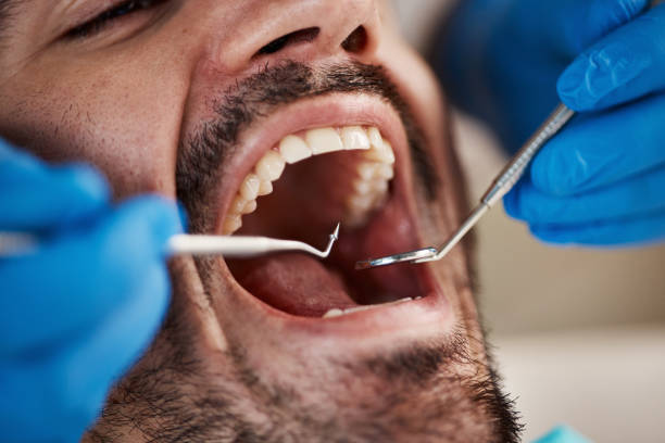 Best Emergency Dental Care for Abscessed Tooth in Horatio, AR